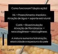 PREENCHEDORES HÍBRIDOS (HA + CaHA): a combinação que une ...