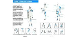 Motor Point Therapy Chart Acupuncture Lasers Net