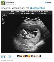 Lets you edit the exif meta data. This Viral Pregnancy Hoax Has Everyone On The Edge Of Their Seats