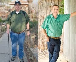 Bariatric Revision Surgery Weightwise Bariatric Program In Oklahoma