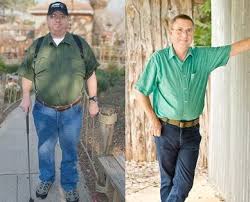 Do not assume that your job is finished. Health Choice Weight Loss Surgery Lp Weightwise Bariatric Program