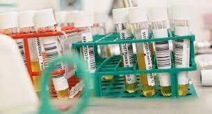 How Plasma Donations Can Help Patients With Von Willebrand Disease Canadian Plasma Resources