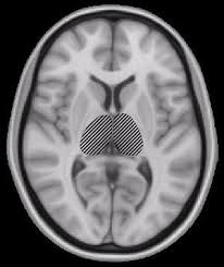 Multiple sclerosis (ms) is a condition that can affect the brain and spinal cord, causing a wide range of potential symptoms, including problems with vision, arm or leg movement, sensation or balance. Primera Medicion Directa De La Mielina De La Medula Espinal En La Esclerosis Multiple Esclerosis Multiple Esclerosis Medula Espinal