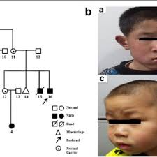 Partial G banded karyotype showing the normal chromosome 8 and the...