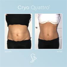 We also offer a range Sculpt Pro Aesthetics