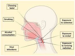 Laryngeal Cancer in the Modern Era: Evolving Trends in Diagnosis,  Treatment, and Survival Outcomes