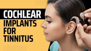 Image result for Cochlear Implant