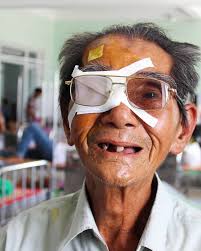 The Fred Hollows Foundation