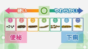 原因別 肩こりのためのエクササイズ 筋肉の過度の緊張が原因の肩こり nhk健康チャンネル 健康 治療 閉塞性動脈硬化症