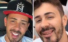 зображенняlentedecontato kevinho dente meme / kevinho aparece sem / kevinho aparece sem / kevinho aparece sem / kevinho mostra dente / kevinho aparece sem / kevinho aparece sem / kevinho aparece sem / kevinho aterroriza f / kevinho aparece sem / kevinho aparece sem / kevinho vira meme ao / kevinho mostra dente / kevinho ostenta volu. Especialista Explica Imagens Chocantes De Desgaste Dentario De Famosos Apos Uso De Lentes E Tira Duvidas Sobre Procedimento