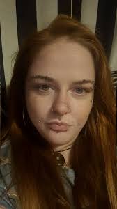 Will a slit in the front of a tongue piercing close?