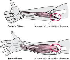 Pin On Natural Healing
