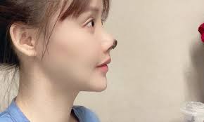 To push or move with the nose or front forward. Penalty For Plastic Surgery Hospital Where Gave Chinese Actress Necrotic Nose Announced Global Times