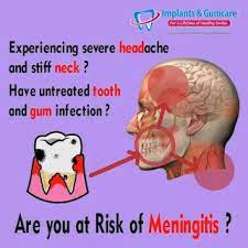 Do You Know Tooth Infection Causes Brain Fever A Condition Of Meningitis Meningitis Toothdecay Dentist Tooth Caries Tooth Infection Gum Care