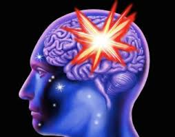 Brain Hemorrhage Causes Symptoms Treatment Live Science