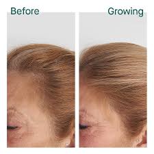 With regular care how long does hair grow in a month? Nutrafol Professional Partner Newport Permanent Makeup