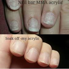 If Your Nails Look Like The Top Picture After Acrylic Removal Most Likely Your Salon Nail Tech Is Using Mma Acrylic Mo Nails After Acrylics Damaged Nails Nails