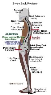 Pin On Myofascial Pain