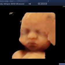 Profile for Baby Glimpse