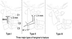 Image result for Subaxial Injury Classification Scale