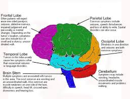 Symptoms of brain tumors in the brainstem (base of brain) may include: Brain Tumor Early Symptoms Tumornew Pic Brain Tumor Awareness Childhood Cancer Awareness Brain Tumor Symptoms