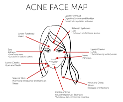 acne face map what acne revealing about your health