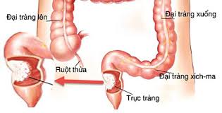 Một là phiên bản thường và hai là phiên bản hắc ám. Trá»±c Trang La Gi Cáº¥u Táº¡o Nháº­n Biáº¿t Ä'au Trá»±c Trang