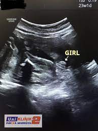Hasil foto poco f3 hasil foto vivo x60. Baby Girl Gambar Scan Jantina Bayi Perempuan