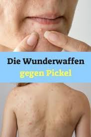 Pin On Naturliche Heilmittel