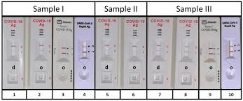 Check spelling or type a new query. Sars Cov 2 Antigen Detection To Evaluate The Suitability Of Specimen Download Scientific Diagram