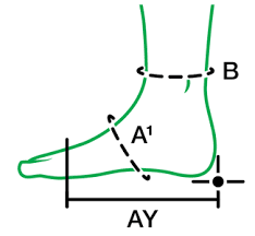 Readywrap Foot Sl