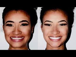 COLOQUEI LENTE DE CONTATO DENTAL #DAYTODODIA21