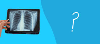 Tall and thin people are more likely to develop a primary spontaneous pneumothorax. Atelectasis Vs Pneumothorax Compare Causes Symptoms Treatments