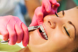 Image result for orthodontist