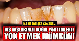 Bazı hindistancevizi yağı sıvılaşıncaya kadar eritin ve bakterileri ağzından çıkarmak için bir gargara olarak kullanın. Dis Taslari Dogal Yollarla Nasil Temizlenir