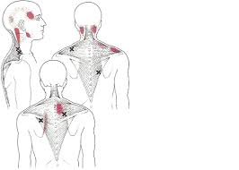 Also, does doing this so often cause any permanent damage? Neck Pain Avenue Chiropractic Clinic Southampton