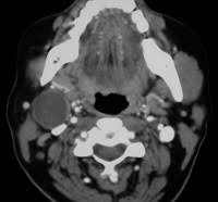 Cat scans, mri scans, ultrasound, and mibg are shown and described. Ct Scan Cat Scan Procedure Side Effects Purpose Ct Vs Mri