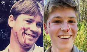 Crocs down under steve irwin documentary | real wild. Robert Irwin Shares Footage Of Him Being Bitten By A Snake Just As Steve Irwin Did Years Ago Daily Mail Online