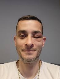 I've been toying with the idea of ​​getting a few bee colonies and becoming  a hobby beekeeper for a long time. is there a beekeeper among us? Greetings  from Westphalia/Germany