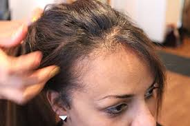 Heat about half a cup to 1 cup of coconut oil on the stove not in the microwave. Before After Photos How To Put In Maintain Take Out A Sew In Weave Best Method Technique Products To Use Hairstyle Trends 2013 2014 Beautystat Com