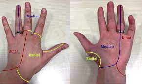 Sometimes the numbness is worse at night. A Painful Tingling Hand The Bmj