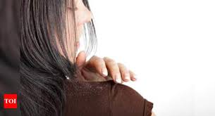 No one really knows what causes dandruff but it may be caused by the. Dealing With Dandruff Times Of India