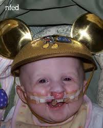 🌱 See how Ally has grown! 🌼 Ally was diagnosed with  ectrodactyly-ectodermal dysplasia-clefting (EEC) syndrome as a baby, but  that's never defined her. Thanks in part to the NFED community, music has