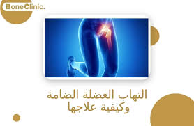 التهاب العضلة الضامة وكيفية علاجها