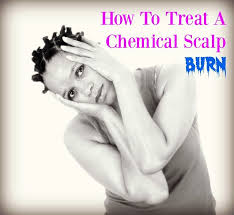 Natural Hair Beauty Style How To Treat A Chemical Scalp Burn Chemical Burn Treatment Chemical Burn Skin Burns