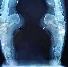 Pointe Shoe X Ray Dancers Feet Just Dance Dance Workout