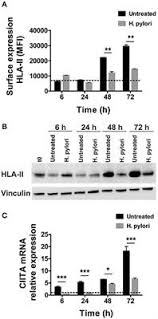Pylori) is a type of bacteria. Frontiers Helicobacter Pylori Dampens Hla Ii Expression On Macrophages Via The Up Regulation Of Mirnas Targeting Ciita Immunology