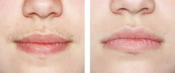 Some upper lip hair removal methods can be done at the comfort of your home. 13 Before And After Face Eyebrow Threading Ideas Threading Eyebrows Eyebrows Face