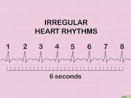 Ia juga biasa disebut nadi. Cara Menghitung Detak Jantung Melalui Ekg 8 Langkah