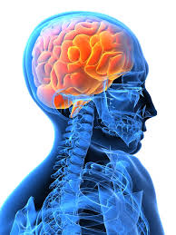 Stroke Treatment and Management of Its Effects with Ayurveda | Best Ayurveda  Hospital in Chennai | Ayurveda treatment in chennai